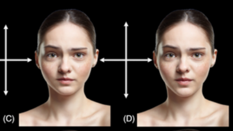 医美优质文章推荐: 面部比例：视错觉在面部美容填充注射中的作用
