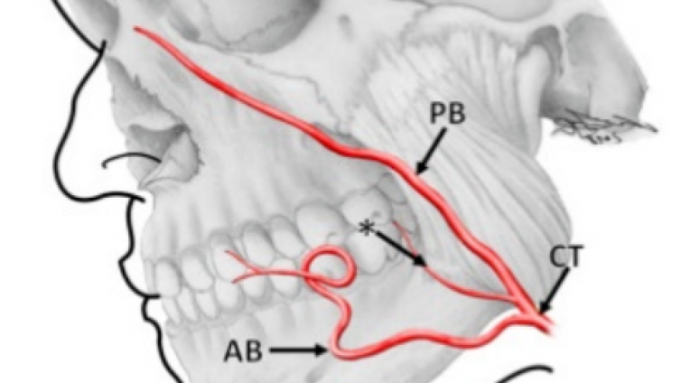 医美优质文章推荐: 高阶解剖：面动脉的走行模式与一例罕见的面动脉分支