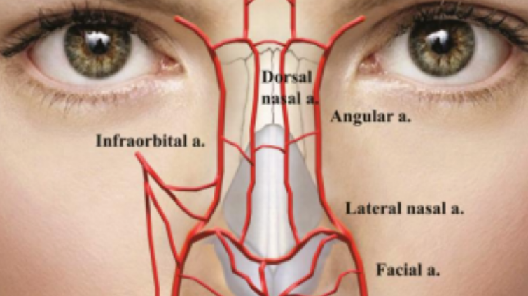 医美优质文章推荐: 高阶解剖：下鼻动脉丛及其对填充剂安全注射的影响
