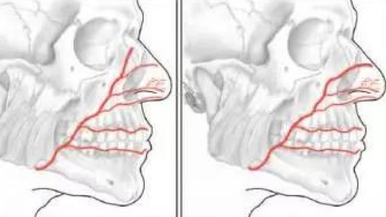 医美优质文章推荐: 外鼻：鼻部动脉和走行及其与鼻唇沟的关系